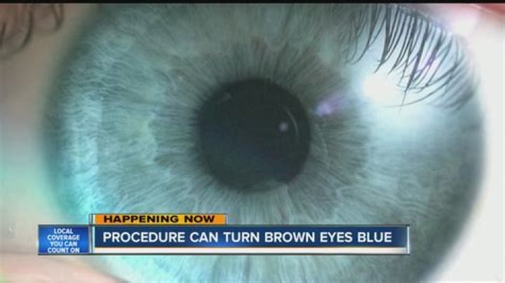 Can you turn brown eyes blue with surgery?