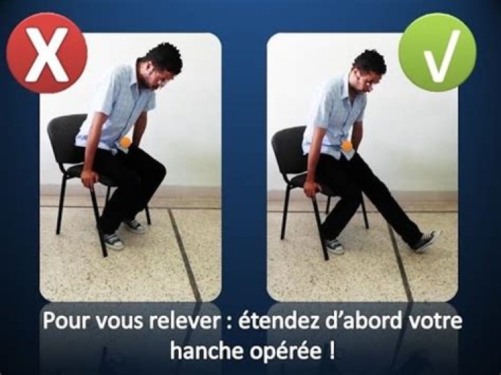 Comment eviter la luxation de la hanche ?