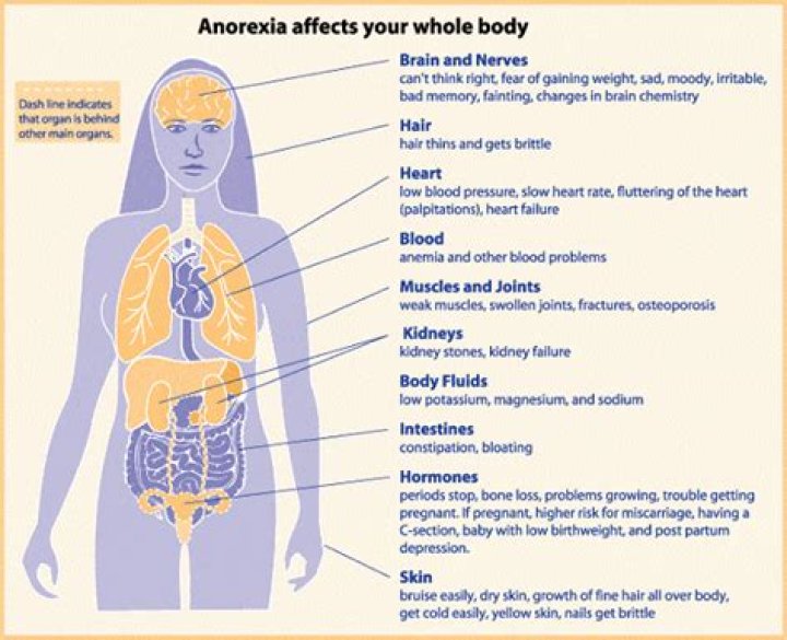 Do Anorexics have bad skin?