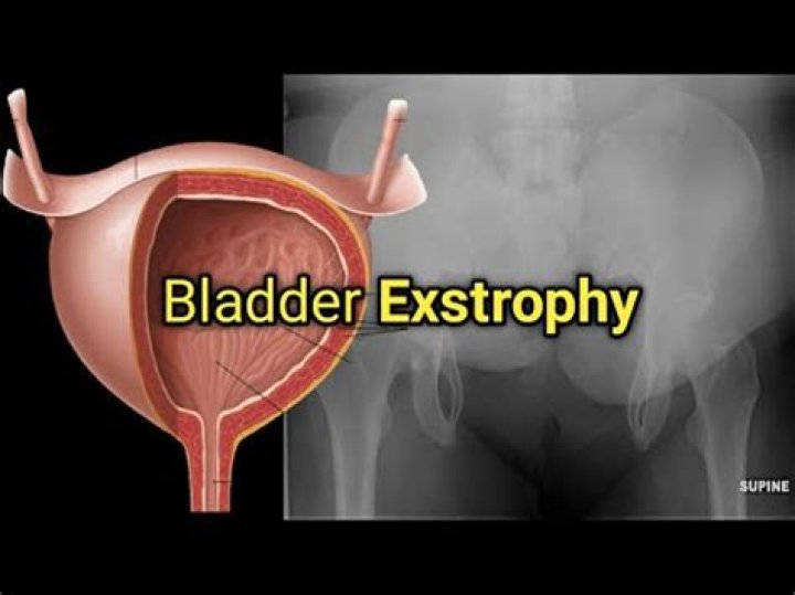 Do Babies Press bladder?