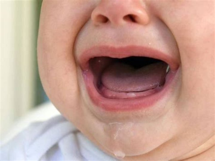 Do babies teeth hurt after they break through the gums?