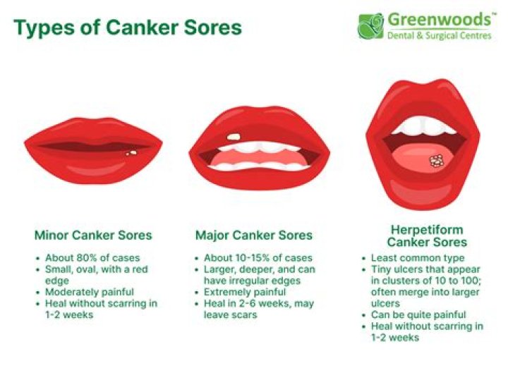 Do canker sores cause swelling?