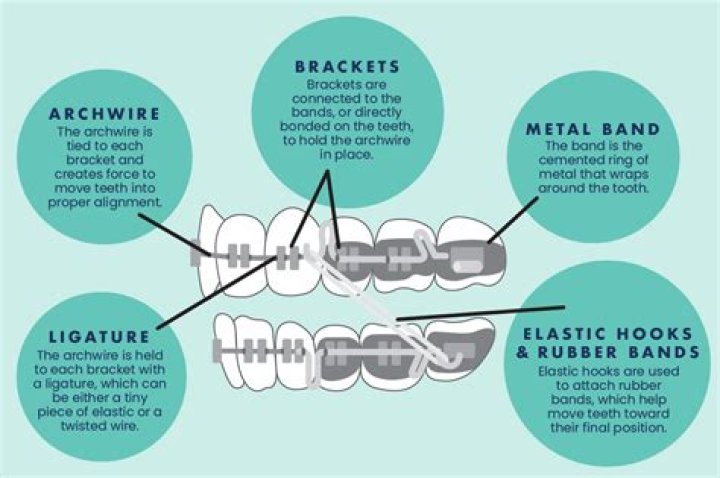 Do groin braces work?