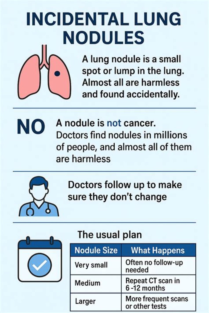 Do lung nodules need to be removed?