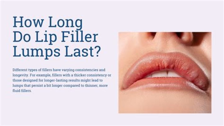 Do the lumps in lip fillers go away?