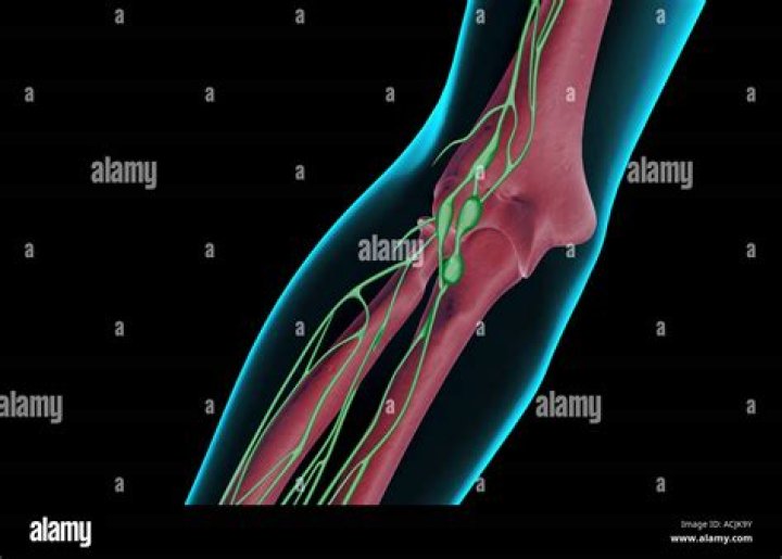 Do you have lymph nodes on the inside of your elbow?