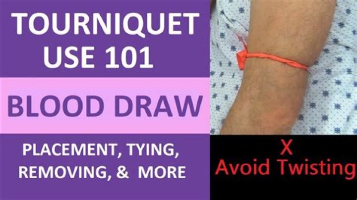 Do you keep tourniquet on when drawing blood?