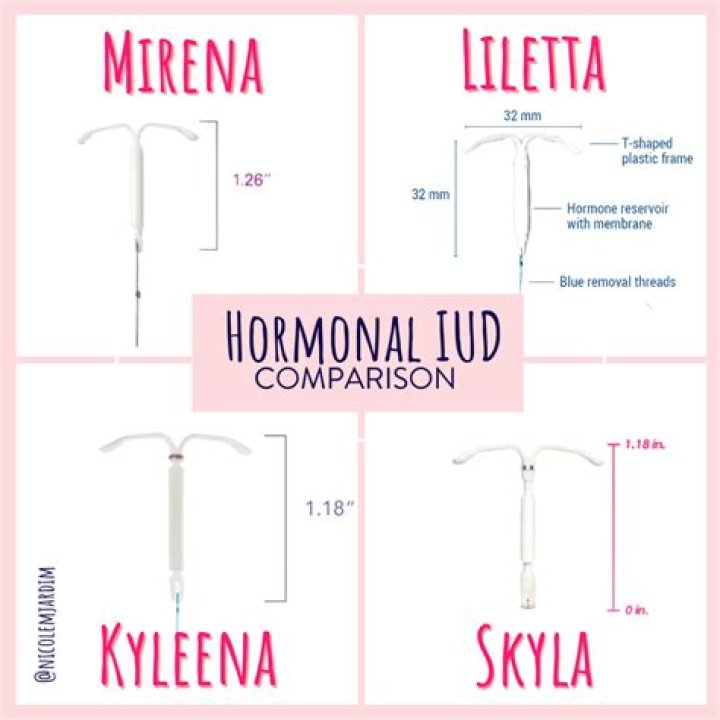 Do you ovulate on Kyleena IUD?