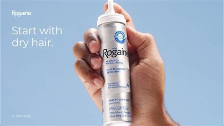 Do you put Rogaine on wet or dry hair?