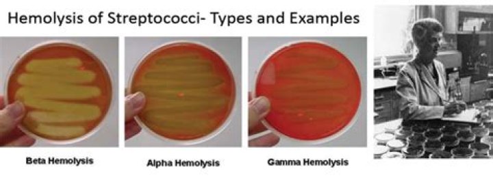 Do you treat non group A beta-hemolytic strep?