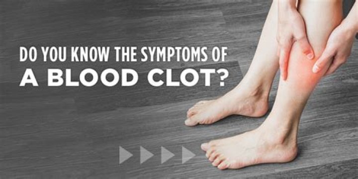 Does a blood clot cause a lump?