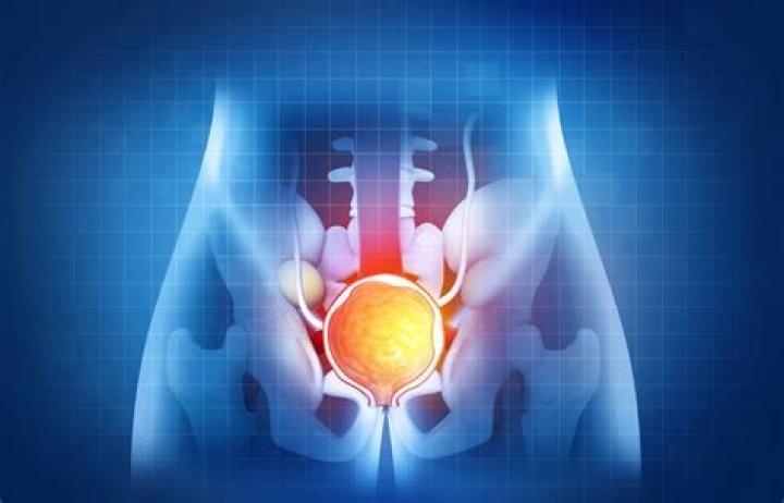 Does a woman have prostate?