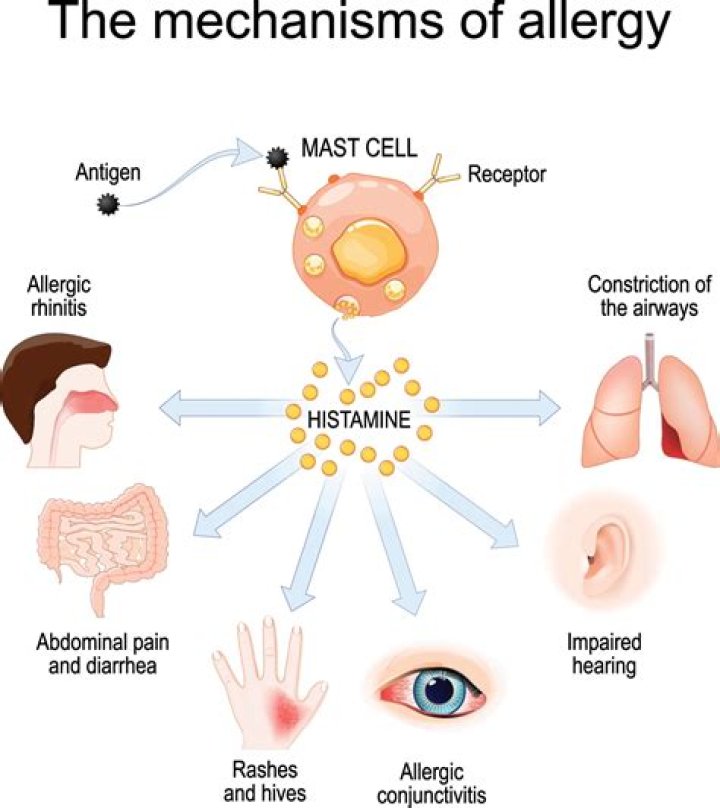 Does allergic reaction cause constipation?