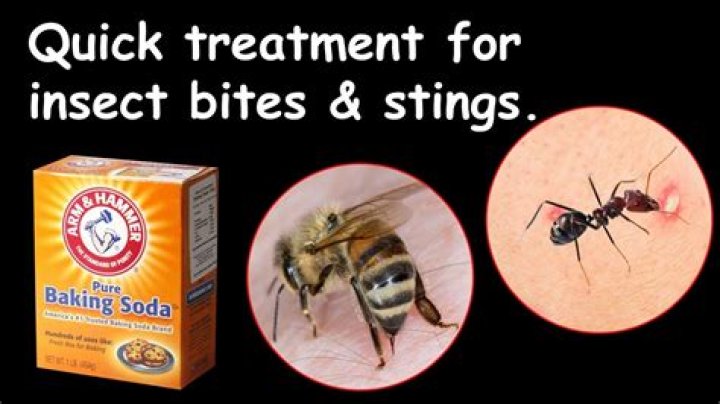 Does baking soda paste help bee stings?
