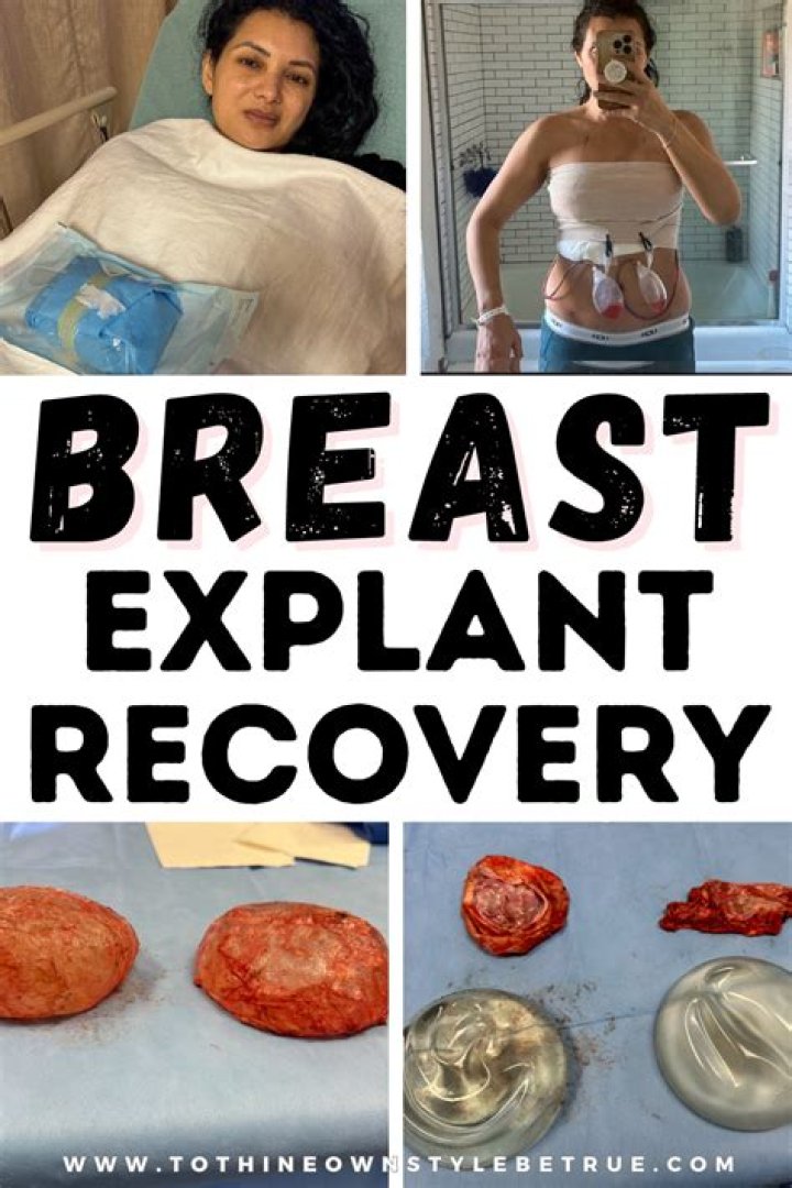 Does Blue Cross Blue Shield Cover breast explant surgery?