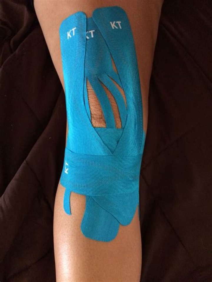 Does KT Tape help after ACL surgery?