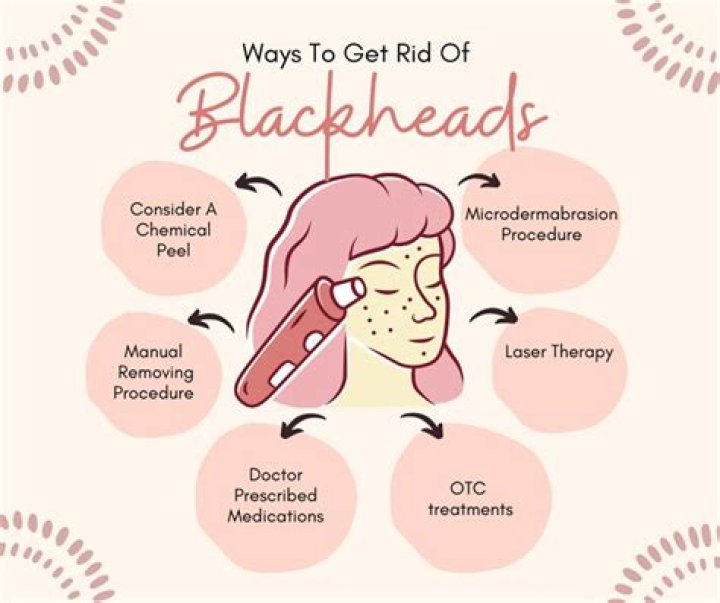Does lemon and baking soda get rid of blackheads?