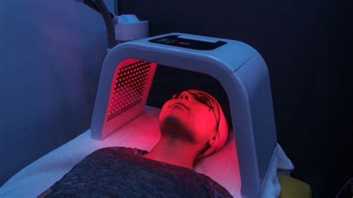 Does red light therapy work for cold sores?