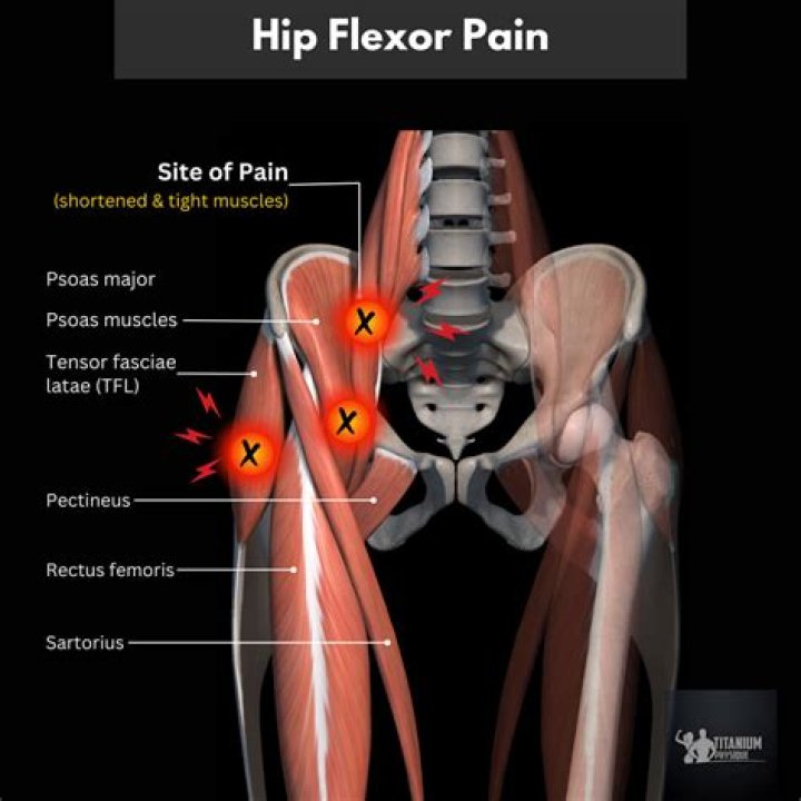 Does relaxin cause hip pain?