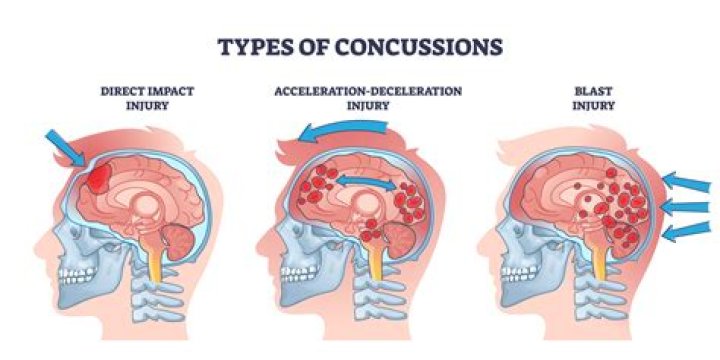 Does the NHL take concussions seriously?