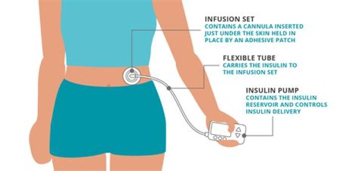 Does United Healthcare cover insulin pumps?