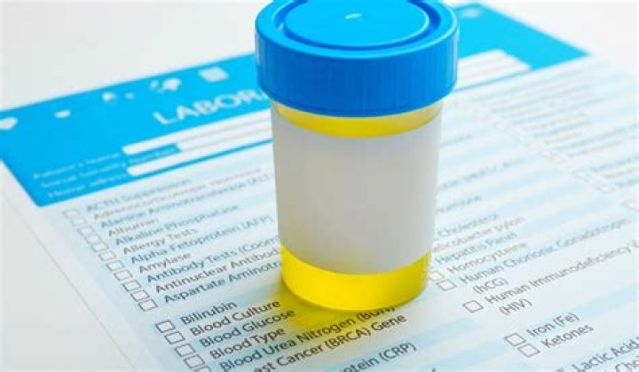 Does venlafaxine show up on a urine test?