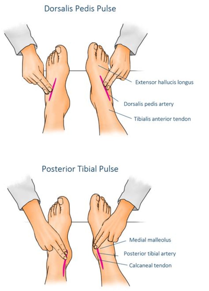 Does weak pulse in feet mean?