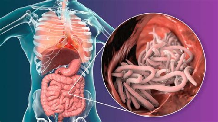 Does worms make sound in the stomach?