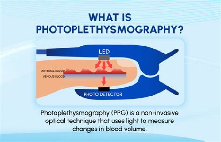 How accurate is Photoplethysmography?