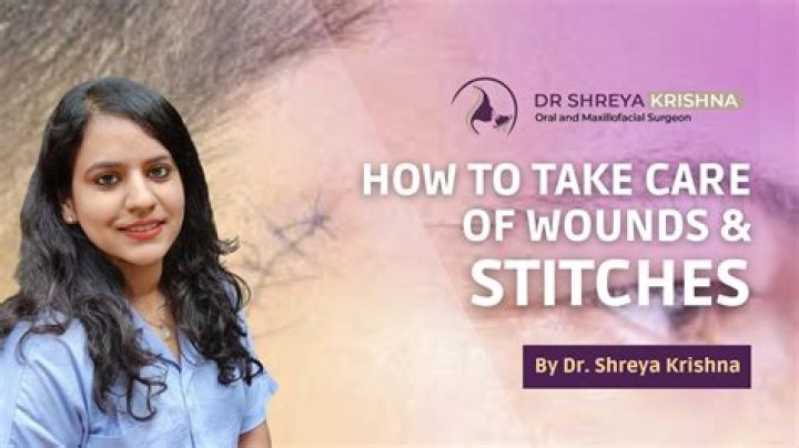 How are new stitches treated?