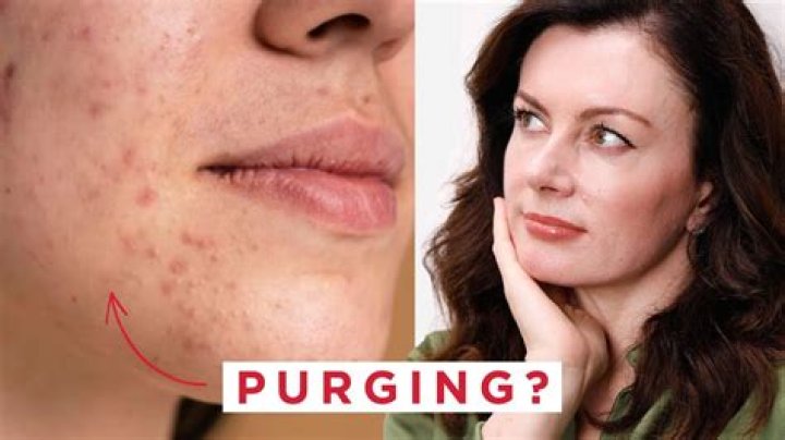 How can I help purging?