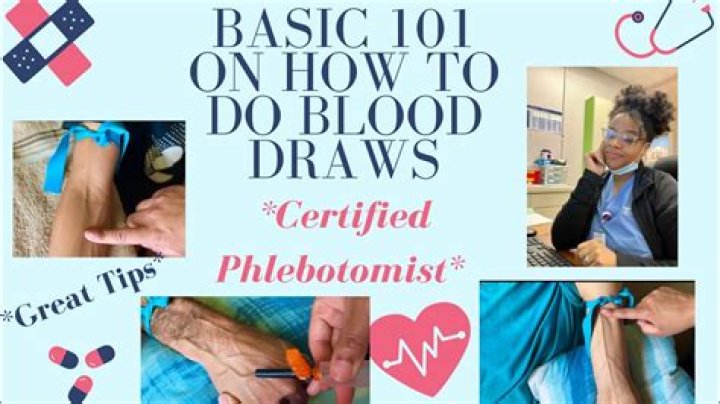 How can I improve my phlebotomy team?