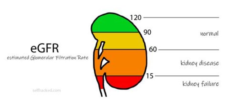 How can I increase my non African American GFR?