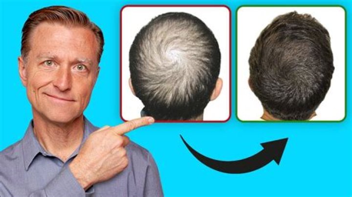 How can I regrow hair on the front of my head?