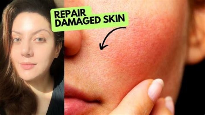 How can I repair my skin naturally?
