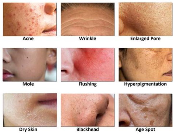 How can I solve my face skin problem?