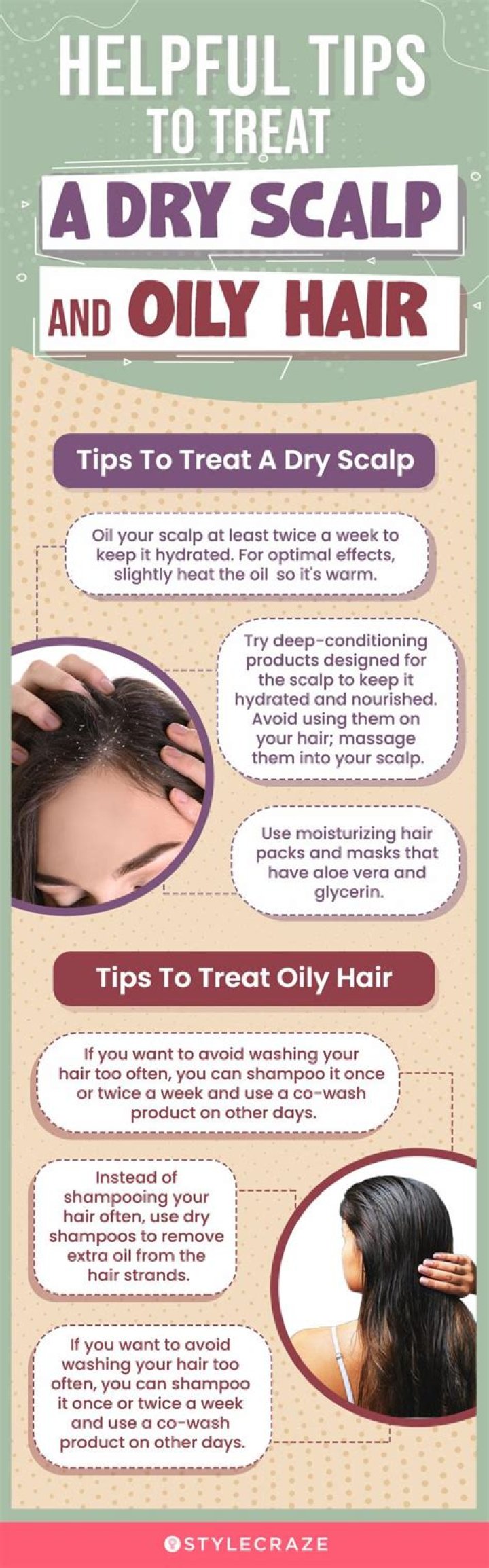 How can I stop my scalp being so dry?