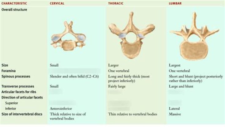 How can you distinguish the 3 main types of vertebrae?