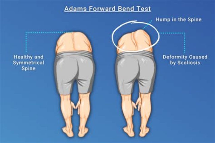 How come when I bend over my eyes hurt?