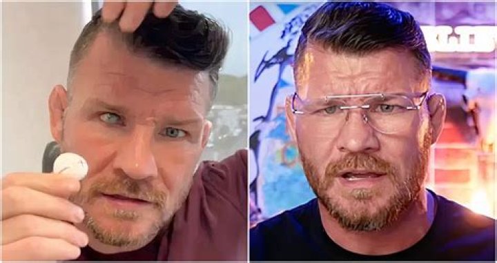 How did Michael Bisping lose his eye?