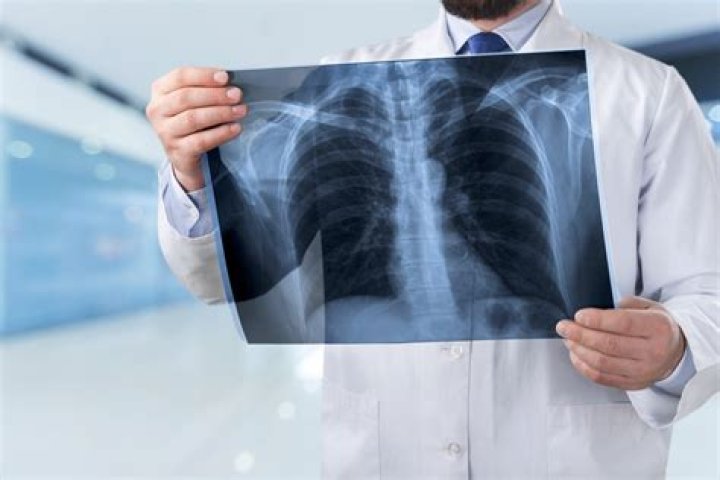 How do doctors check for mesothelioma?