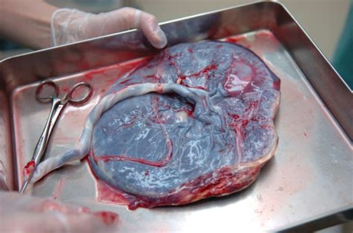 How do I clean my placenta?