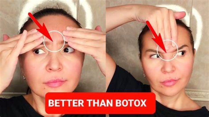 How do I get rid of frown lines between my eyebrows without Botox?