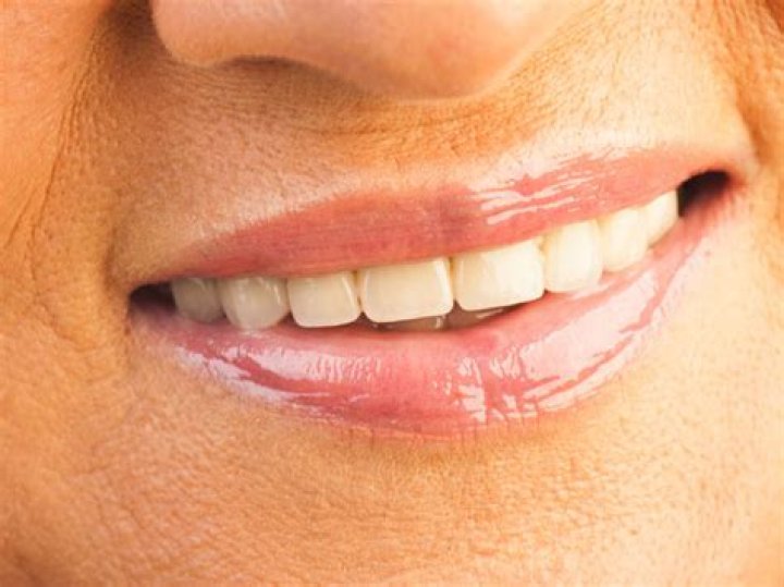 How do I get rid of the dark ring around my mouth after licking?