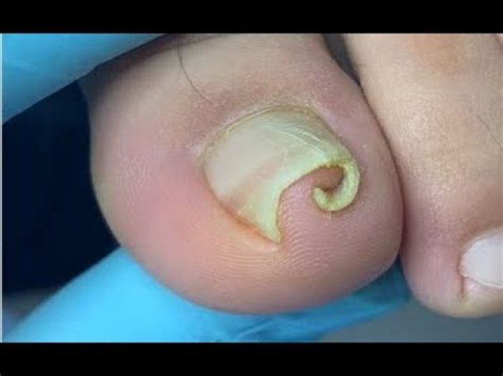 How do I stop my nails from curling?