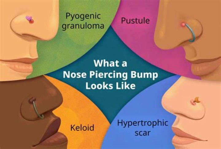 How do I take my nose piercing back out?
