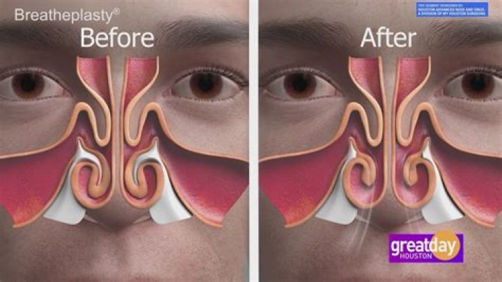 How do I widen my airways?