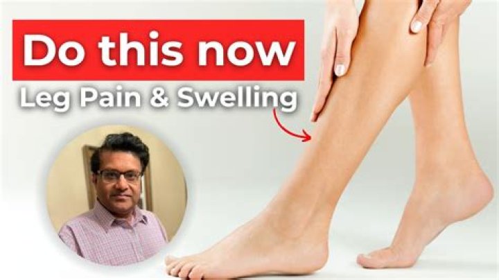 How do they remove a blood clot in your leg?