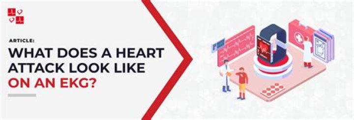 How do they test for previous heart attacks?