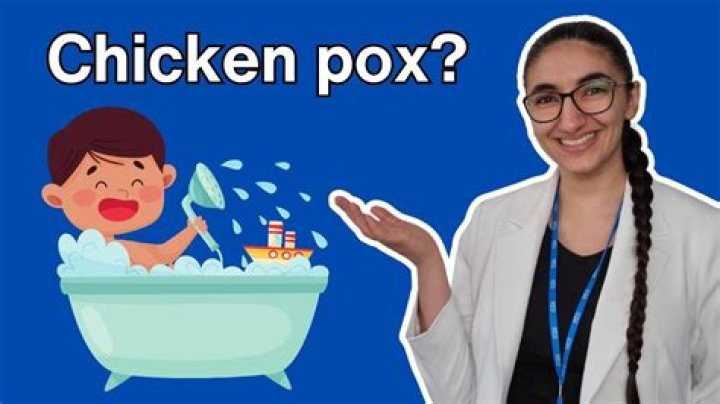 How do you bath with chicken pox?